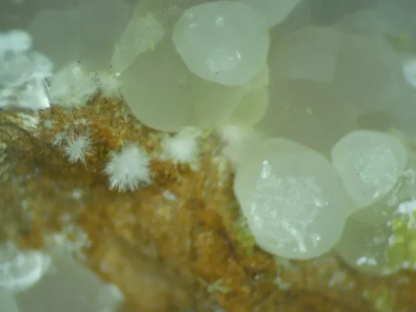 Hydroxylapatite, Carbonate-rich Fluorapatite